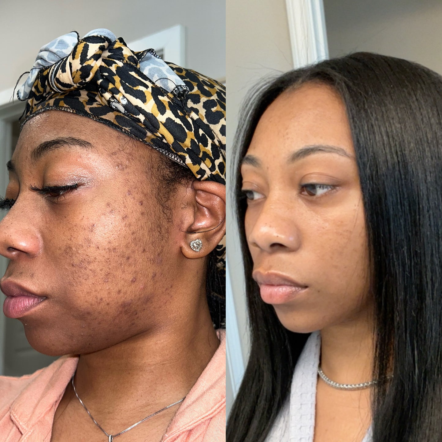 New Erà Brightening Bar