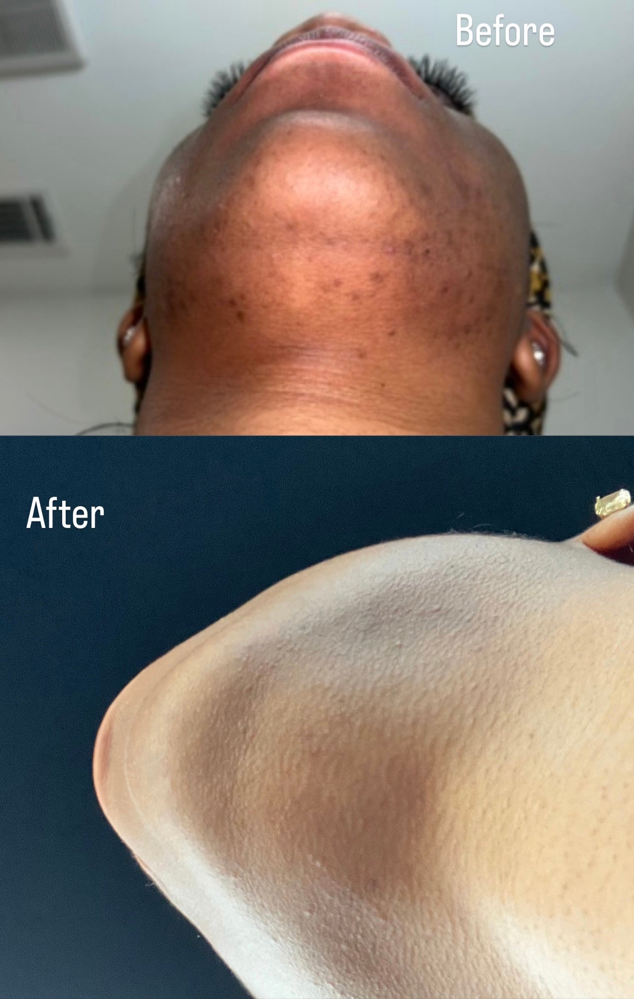 New Erà Brightening Bar