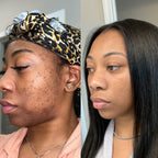 New Erà Brightening Bar