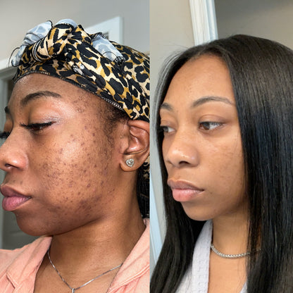 New Erà Brightening Bar